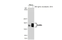 Anti-Anillin antibody [HL6408] used in Western Blot (WB). GTX648853