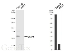 Anti-GATA6 antibody [HL6413] used in Western Blot (WB). GTX648858