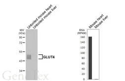 Anti-GLUT4 antibody [HL6419] used in Western Blot (WB). GTX648864