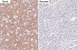 Anti-PLCG2 antibody [HL6425] used in IHC (Paraffin sections) (IHC-P). GTX648870