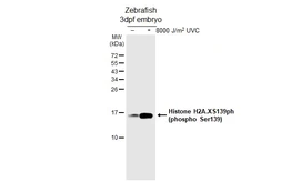 Anti-Histone H2A.XS139ph (phospho Ser139) antibody [HL4533-MS] used in Western Blot (WB). GTX648885