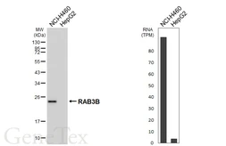 Anti-RAB3B antibody [HL6442] used in Western Blot (WB). GTX648890