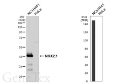Anti-NKX2.1 antibody [HL6474] used in Western Blot (WB). GTX648922