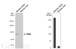 Anti-FAK antibody [HL6480] used in Western Blot (WB). GTX648928
