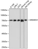 Anti-KREMEN1 antibody used in Western Blot (WB). GTX64893