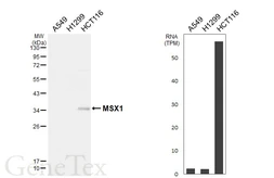 Anti-MSX1 antibody [HL6505] used in Western Blot (WB). GTX648961