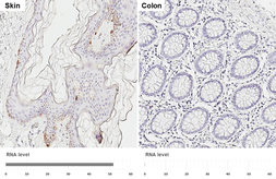 Anti-TRP2 antibody [HL6508] used in IHC (Paraffin sections) (IHC-P). GTX648964