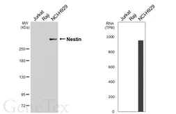 Anti-Nestin antibody [HL6512] used in Western Blot (WB). GTX648968