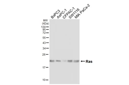 Anti-Ras antibody [HL6523] used in Western Blot (WB). GTX648979