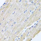 Anti-ABCB8 antibody used in IHC (Paraffin sections) (IHC-P). GTX64900
