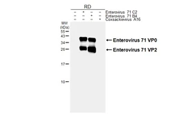 Anti-Enterovirus 71 VP2 antibody [HL6535] used in Western Blot (WB). GTX649005