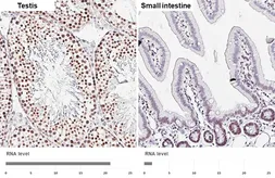 Anti-UBR7 antibody [HL6568] used in IHC (Paraffin sections) (IHC-P). GTX649038