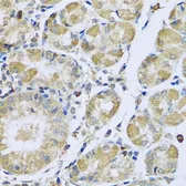 Anti-PMPCB antibody used in IHC (Paraffin sections) (IHC-P). GTX64915