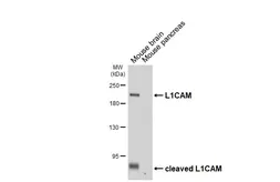 Anti-L1CAM antibody [HL6618] used in Western Blot (WB). GTX649318