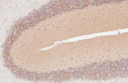 Anti-L1CAM antibody [HL6620] used in IHC (Paraffin sections) (IHC-P). GTX649320