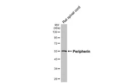 Anti-Peripherin antibody [HL6621] used in Western Blot (WB). GTX649321