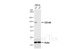 Anti-CD146 antibody [HL6624] used in Western Blot (WB). GTX649324