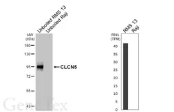 Anti-CLCN5 antibody [HL6625] used in Western Blot (WB). GTX649325