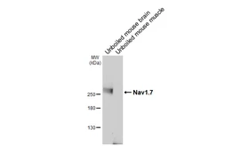 Anti-Nav1.7 antibody [GT434] used in Western Blot (WB). GTX649343