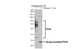 Anti-P2Y8 antibody [HL6649] used in Western Blot (WB). GTX649358