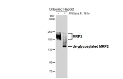 Anti-MRP2 antibody [HL6658] used in Western Blot (WB). GTX649367