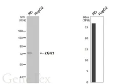 Anti-cGK1 antibody [HL6677] used in Western Blot (WB). GTX649388