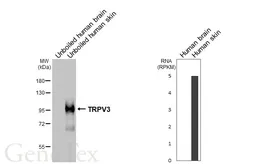 Anti-TRPV3 antibody [HL6778] used in Western Blot (WB). GTX649509
