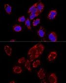 Anti-TEFM antibody used in Immunocytochemistry/ Immunofluorescence (ICC/IF). GTX64957