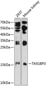 Anti-TAX1BP3 antibody used in Western Blot (WB). GTX64958