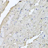 Anti-USH1C antibody used in IHC (Paraffin sections) (IHC-P). GTX64965