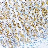 Anti-Activin Receptor Type IC antibody used in IHC (Paraffin sections) (IHC-P). GTX64969