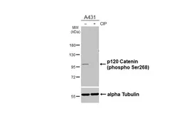 Anti-p120 Catenin (phospho Ser268) antibody [HL6869] used in Western Blot (WB). GTX649713