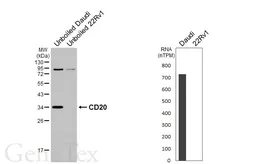 Anti-CD20 antibody [GT451] used in Western Blot (WB). GTX649727