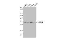 Anti-CDK2 antibody [HL6918] used in Western Blot (WB). GTX649770