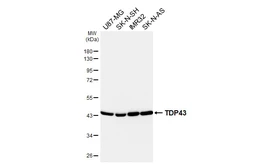 Anti-TDP43 antibody [GT733-CHK] used in Western Blot (WB). GTX649777