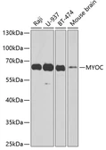 Anti-Myocilin antibody used in Western Blot (WB). GTX64982