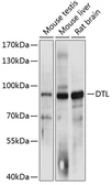 Anti-CDT2 antibody used in Western Blot (WB). GTX64998