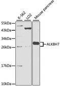 Anti-ALKBH7 antibody used in Western Blot (WB). GTX65589