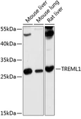 Anti-TREML1 antibody used in Western Blot (WB). GTX65612