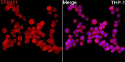 Anti-SSA1 antibody used in Immunocytochemistry/ Immunofluorescence (ICC/IF). GTX65834