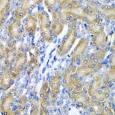 Anti-alpha A Crystallin antibody used in IHC (Paraffin sections) (IHC-P). GTX65843