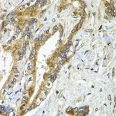Anti-Apc6 antibody used in IHC (Paraffin sections) (IHC-P). GTX65871