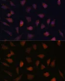 Anti-TREX1 antibody used in Immunocytochemistry/ Immunofluorescence (ICC/IF). GTX65894