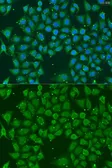 Anti-AKR7A3 antibody used in Immunocytochemistry/ Immunofluorescence (ICC/IF). GTX65900