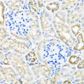 Anti-TIRAP antibody used in IHC (Paraffin sections) (IHC-P). GTX65910