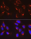 Anti-COPB2 antibody used in Immunocytochemistry/ Immunofluorescence (ICC/IF). GTX65917