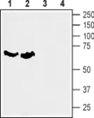 Anti-SLC6A7 antibody used in Western Blot (WB). GTX65943
