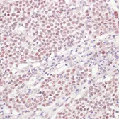 Anti-U1 snRNP70 antibody used in IHC (Paraffin sections) (IHC-P). GTX65948