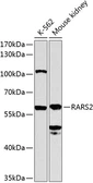 Anti-RARS2 antibody used in Western Blot (WB). GTX65980