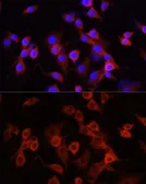 Anti-alpha 1 Antitrypsin antibody used in Immunocytochemistry/ Immunofluorescence (ICC/IF). GTX66005